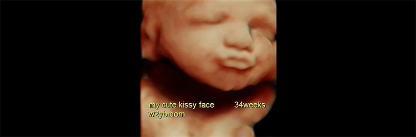 How to Preserve Your Adorable Ultrasound Pictures  Ultrasound pictures,  Ultrasound, Sonogram pictures