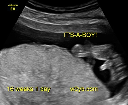 4d ultrasound pictures boy